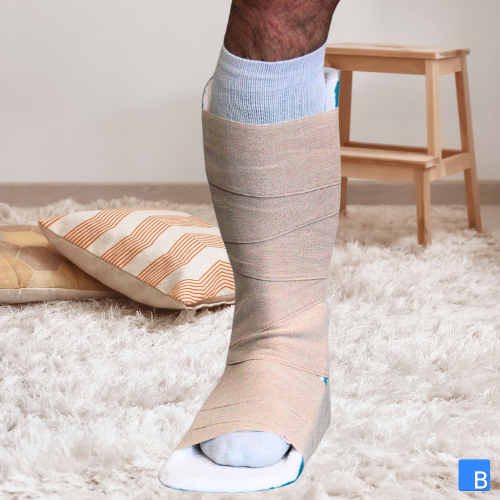 Fixierung der SplintPod Lagerungsschiene mit einer elastischen Binde