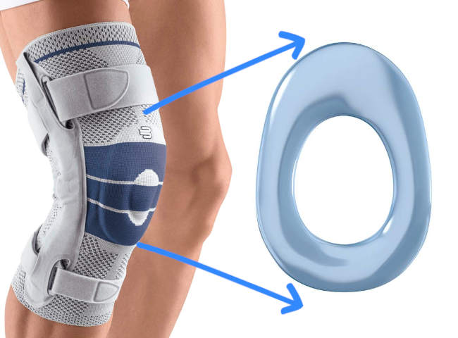 Schematische Darstellung der Ringpelotte, welche die Patella umschliesst und komprimiert