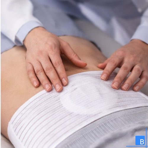 Untersuchung eines Narbenbruchs