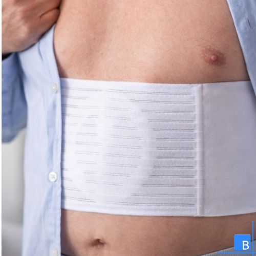 Anwendung Narbenbruchbandage