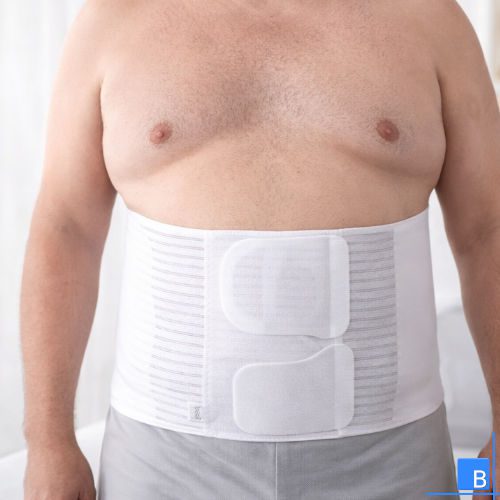 Narbenbruchbandage an einem dicken Bauch